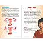 Cancers of the Female Organs 16-page booklet spread, endometrial hyperplasia and cervical cancer risks, Health Edco, 40015
