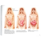 With Child Desk Version spiral bound 78 pages page 55 three female torsos fetal presentation, Childbirth Graphics, 43317