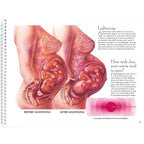 With Child Desk Version spiral bound 78 pages page 49two female torsos before and after lightening, Childbirth Graphics, 43317