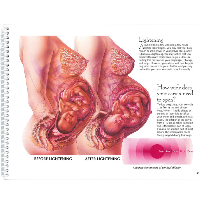 With Child Desk Version spiral bound 78 pages page 49two female torsos before and after lightening, Childbirth Graphics, 43317
