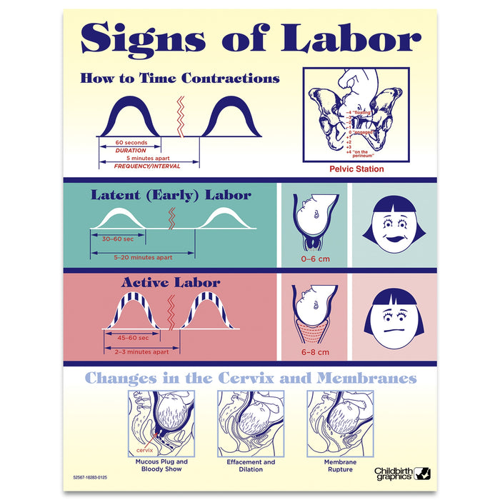 Signs of Labor Tear Pad  by Childbirth Graphics for childbirth education and teaching about labor and cervical changes, 52567