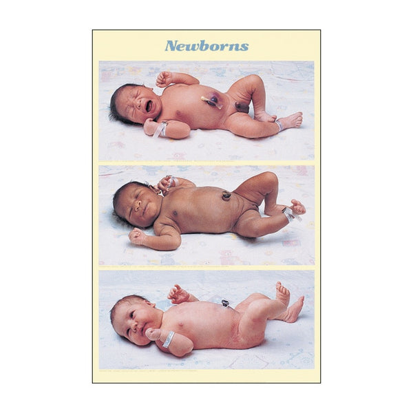 Newborn Size Comparison Chart, 3 separate full-term baby photos hispanic black caucasian each lying on back, Childbirth Graphics, 89635