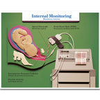 Internal Monitoring Chart, childbirth education chart in the Labor & Birth Intervention Chart Set, Childbirth Graphics, 90615