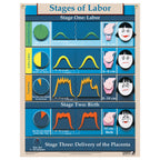 Stages of Labor Chart, childbirth education chart with cutout graphics in English and Spanish, Childbirth Graphics, 90630